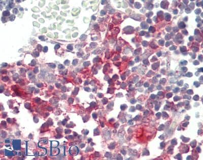Polyclonal Rabbit anti-Human YRDC Antibody (aa136-185, IHC, WB)