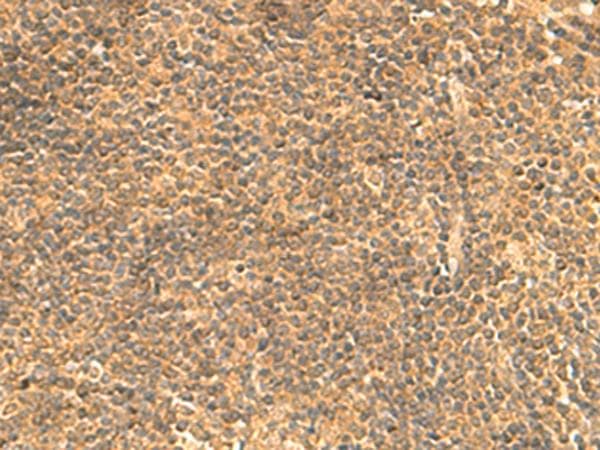 Polyclonal Rabbit anti-Human FAM186B Antibody (IHC)