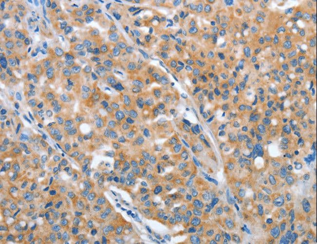 ARFGAP1 Antibody