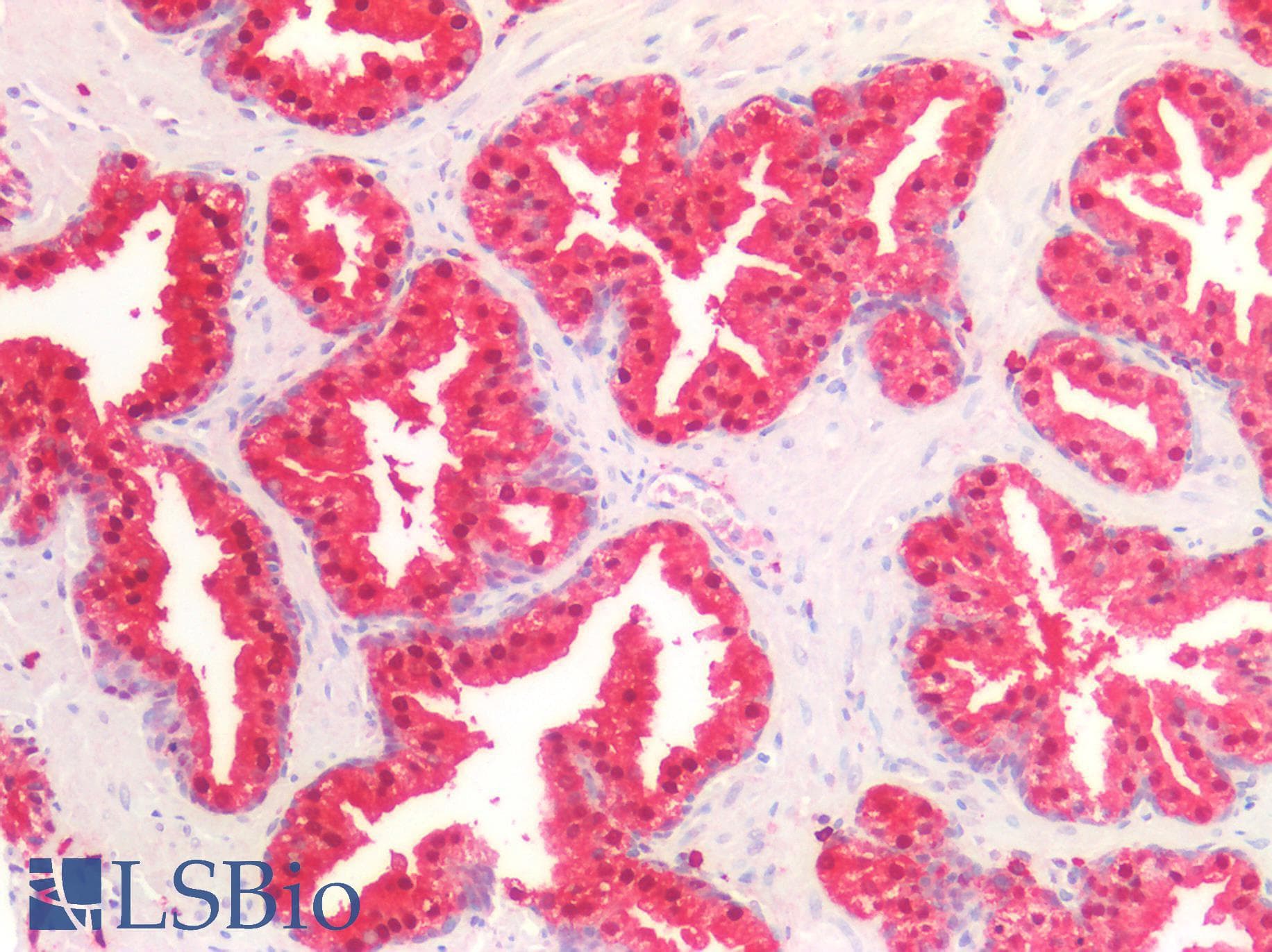 IDH1 / IDH Antibody