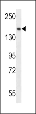 Polyclonal Rabbit anti-Human SMC1A / SMC1 Antibody (aa307-336, WB)