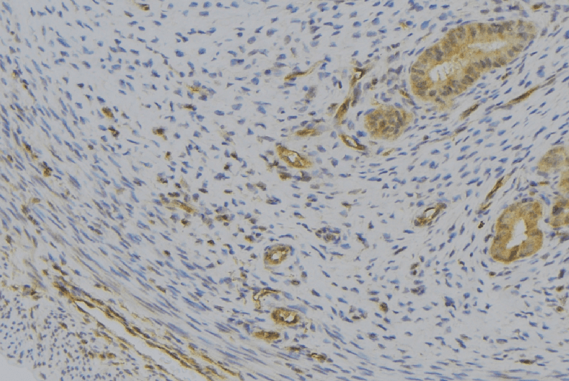 CXCL7 / PPBP Antibody