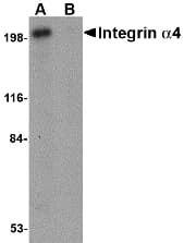 IHC-plus™ Polyclonal Rabbit anti-Human ITGA4 / VLA-4 / CD49d Antibody (IHC, WB)