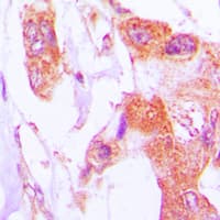 IVL / Involucrin Antibody (C-Terminus)