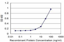 PathPlus™ Monoclonal Mouse anti-Human RET Antibody (clone 1A5, IHC, WB)