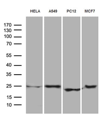 EIF4E3 Antibody (clone OTI2B9)