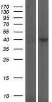 CRLF1 Protein (Over-Expression Lysate Myc-DDK (Flag))