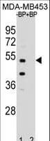 POC1B / WDR51B Antibody (aa321-350)