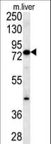 MCCC1 Antibody (aa397-425)
