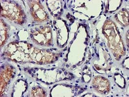PDLIM2 / SLIM Antibody (clone OTI14D9)