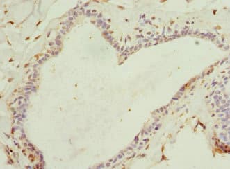 HBXIP Antibody
