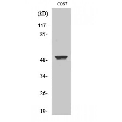 KRT8 / CK8 / Cytokeratin 8 Antibody (10-90 aa)