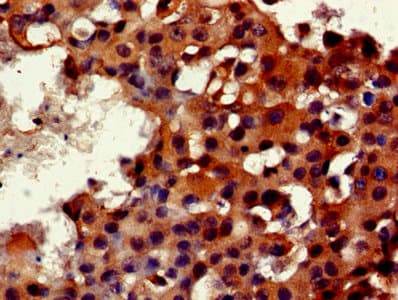 FKBP25 / FKBP3 Antibody (aa2-224)