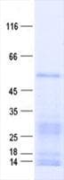 Human AGXT2 Protein (Recombinant His, N-Terminal)