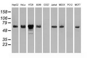 CHEK2 / CHK2 Antibody (clone OTI5C4)