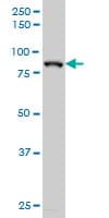 HIC1 Antibody (clone 4E11)