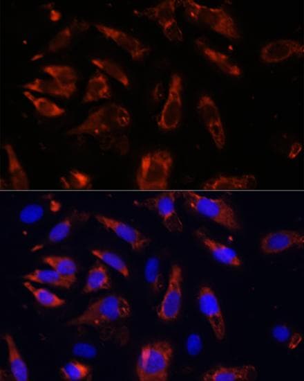 MCTS1 Antibody