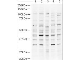 IHC-plus™ Polyclonal Rabbit anti-Human UBP43 / USP18 Antibody (IHC, WB)