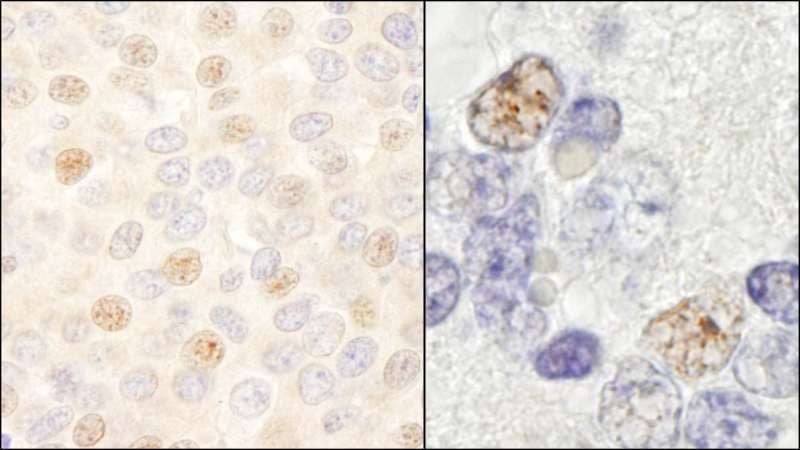 Polyclonal Rabbit anti-Human DDX46 Antibody (aa981-C-term, IHC, WB)