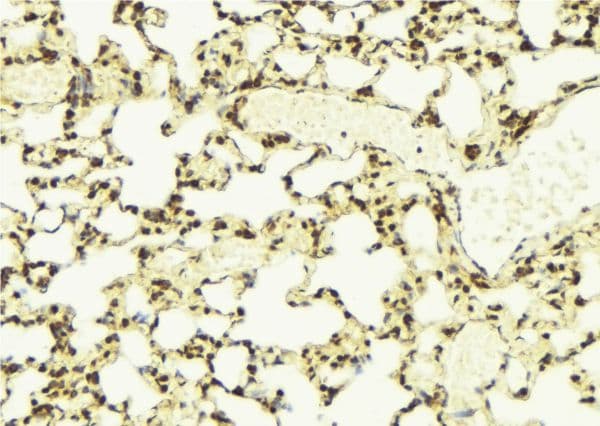 Polyclonal Rabbit anti-Human NEK7 Antibody (IHC, IF, WB)