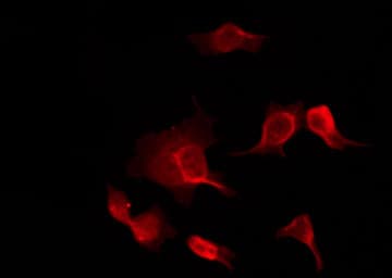 PIM1 / Pim-1 Antibody