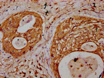 Polyclonal Rabbit anti-Human TNN / Tenascin N Antibody (IHC)
