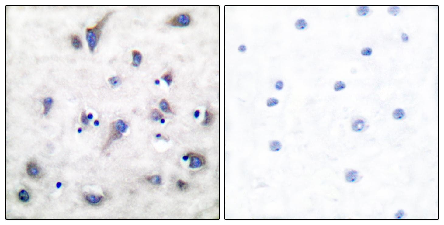 PPP1R1B / DARPP-32 Antibody (phospho-Thr34)