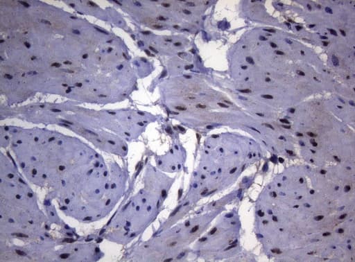 SF1 Antibody (aa1-276, clone OTI7H9, Carrier-free)