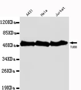 TUBB / Beta Tubulin Antibody