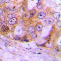 Polyclonal Rabbit anti-Human CASP4 / Caspase 4 Antibody (Internal, IHC, WB)