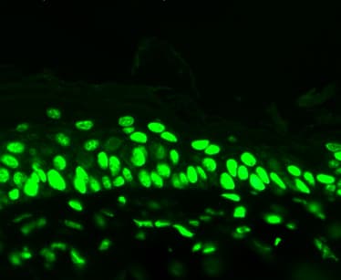 Acetyl-Lysine Antibody (clone 7F8)