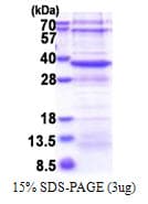 Human NSDHL Protein (Recombinant His)