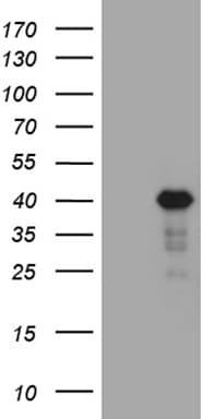 LIMS2 Antibody (aa1-363, clone OTI5H8, Carrier-free)