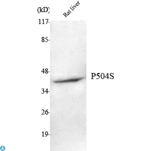 AMACR / P504S Antibody