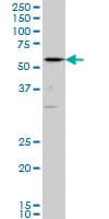 PathPlus™ CBFA1 / RUNX2 Antibody (clone 4D5)