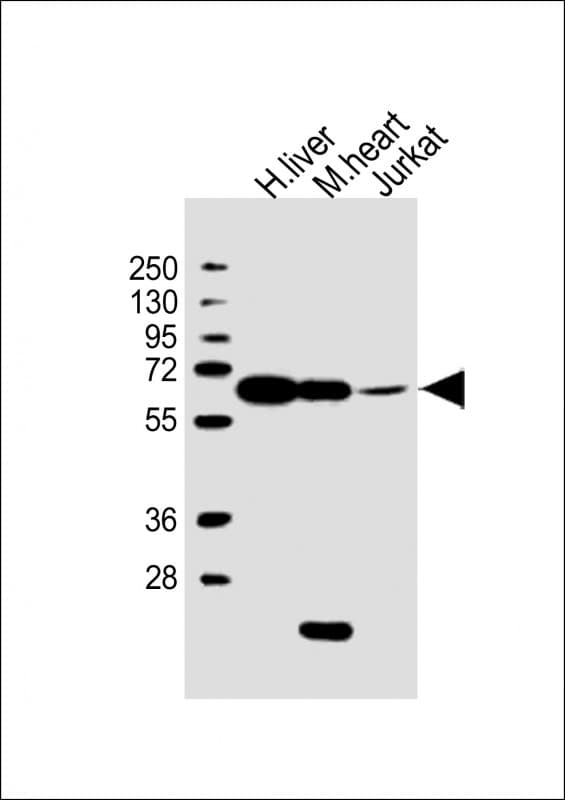 Polyclonal Rabbit anti-Human PGM1 / Phosphoglucomutase 1 Antibody (aa469-501, IHC, WB)