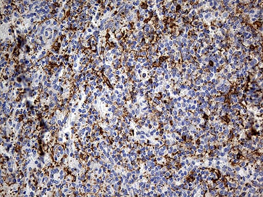 Monoclonal Mouse anti-Human DBN1 / Drebrin Antibody (clone OTI4B1, aa2-240, IHC, WB)