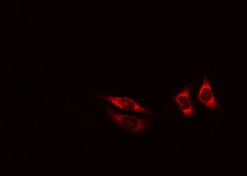 Polyclonal Rabbit anti-Human TXNRD2 Antibody (IHC, IF, WB)