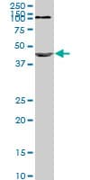 NODAL Antibody (clone 5C3)