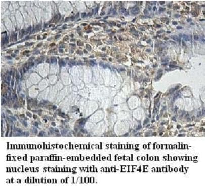 EIF4E Antibody (aa2-217)