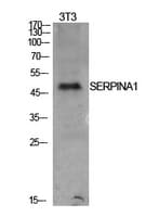 SERPINA1 / Alpha 1 Antitrypsin Antibody