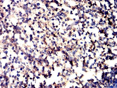 ITGAL / CD11a Antibody (clone 5G7C5)
