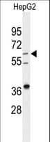 DHCR24 / Seladin-1 Antibody (aa218-246)