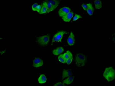 Polyclonal Rabbit anti-Human NALP6 / NLRP6 Antibody (IHC, IF)