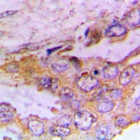 Polyclonal Rabbit anti-Human CAMK1 / CAMKI Antibody (phospho-Thr177, IHC, IF, WB)