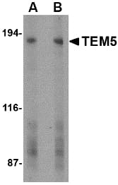 Polyclonal Rabbit anti-Human ADGRA2 / GPR124 Antibody (IHC, WB)