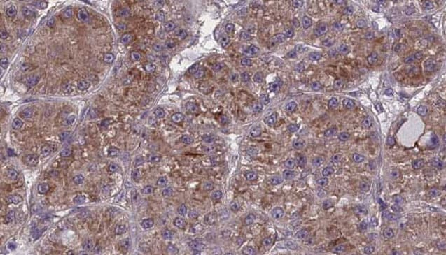 Polyclonal Rabbit anti-Human OR2W1 Antibody (IHC, WB)