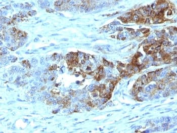 Blood Group H Antibody (clone 19-OLE)