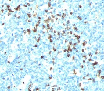 Mouse Anti-Human Lambda Light Chain Secondary Antibody (clone LcN-2, Ready-to-Use)