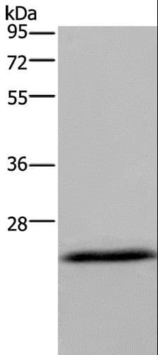 Polyclonal Rabbit anti-Human KCNMB4 Antibody (IHC, WB)